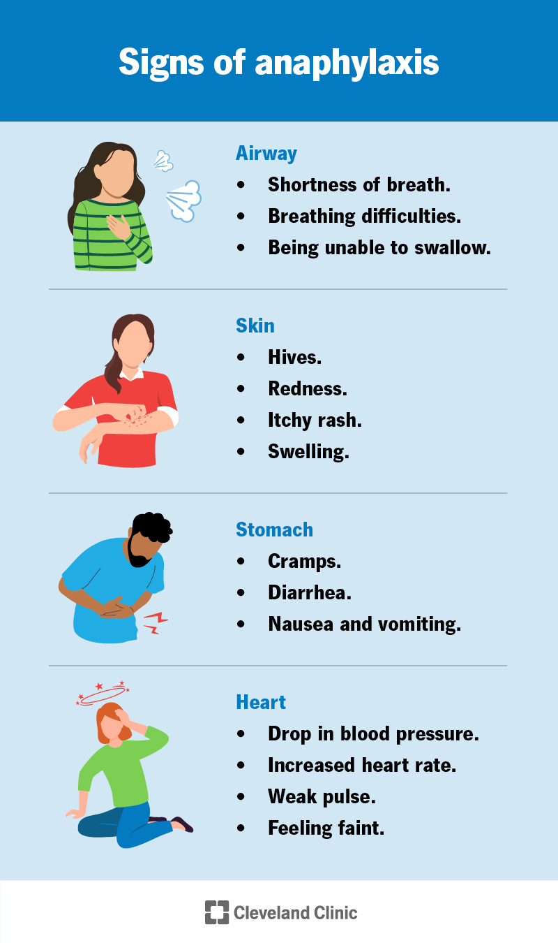<p>Anaphylactic Shock</p>
