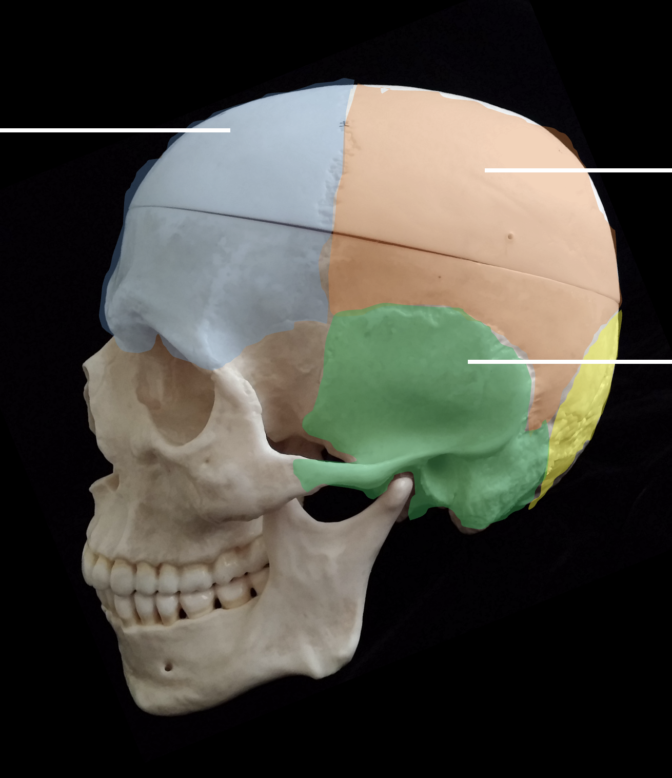 <p>Whats the yellow region highlighted?</p>