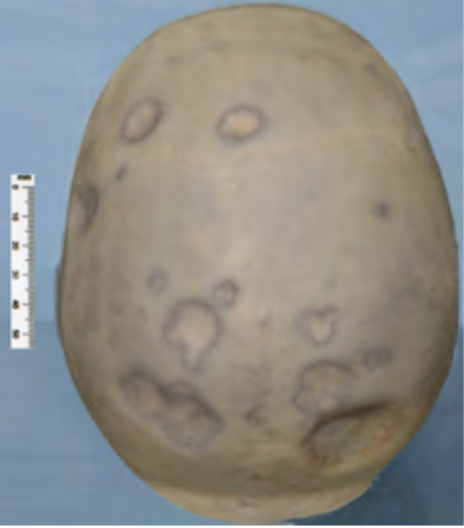 <p>Identify the POT</p>