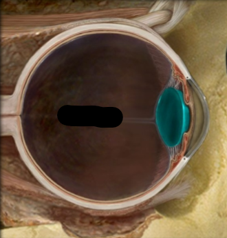 term image