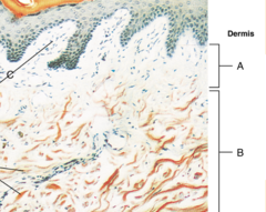 <p>B: 80% of the thickness of the dermis, is dense irregular connective tissue</p>