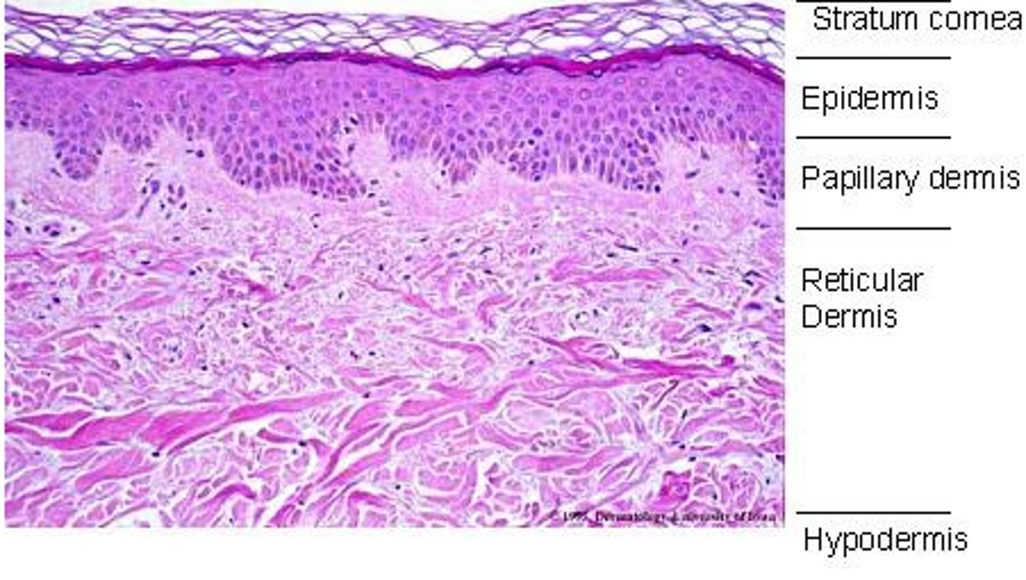 <p>Layers (epidermis on top, dermis below)</p>