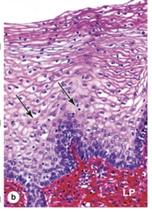 <p>What types of immune cells are relatively abundant in the vaginal mucosa?</p>