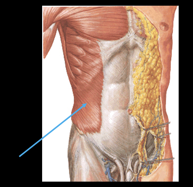 <p>-parallel fibers, often with a falt tendinous sheath (aponeurosis)</p><p>-ex=abdominal obliques; rhomboids</p>