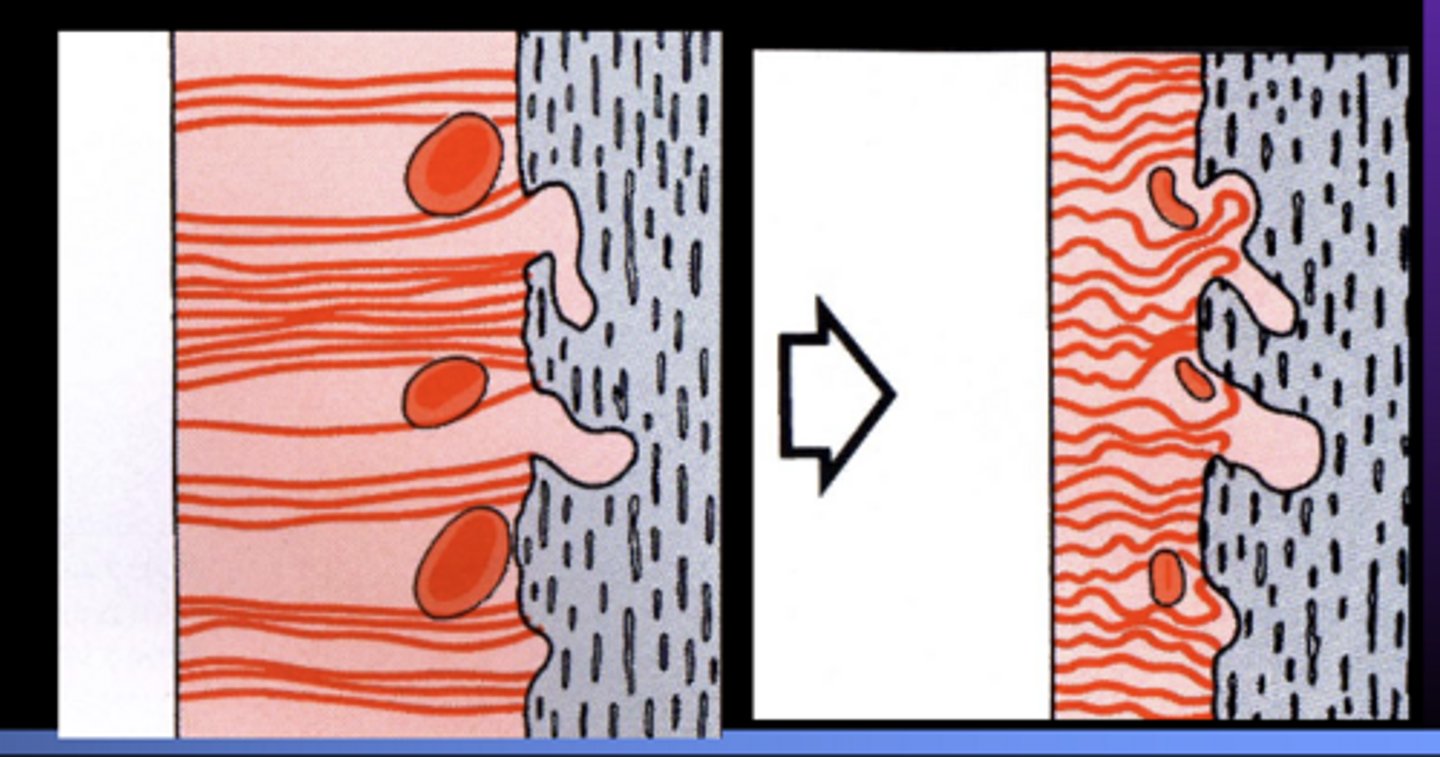 <p>What type of force is on the left vs the right?</p>