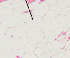 <p>Identify adipose tissue type</p>