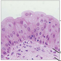 <p>Resembles both stratified squamous and stratified cuboidal; basal cells cuboidal or columnar; surface cells dome shaped or squamous-like, depending on degree of organ stretch. Stretches readily, permits stored urine to distend urinary organ→ storage/increase flow. Lines the ureters, bladder, and part of the urethra.</p>