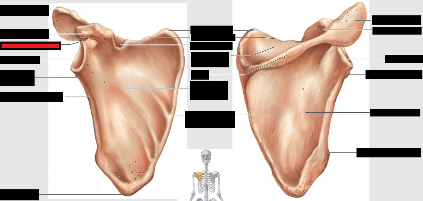 <p>Which part of the scapulae is this?</p>