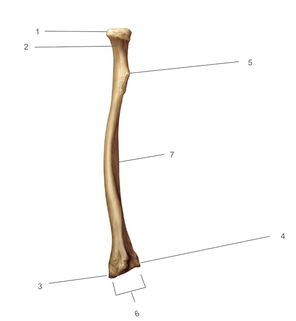 <p>What is number 1 (anterior)?</p>