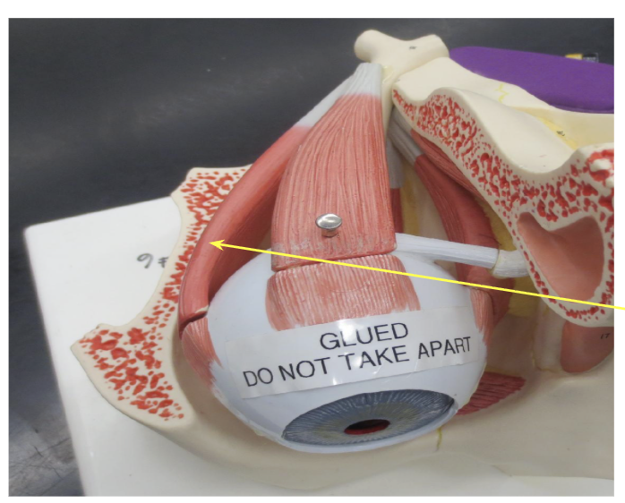 <p>What Muscle is this?</p>