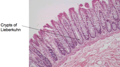 <p>intestinal glands in the mucosa, small openings between villi. the epithelium is continuous with that of the adjacent villi</p>