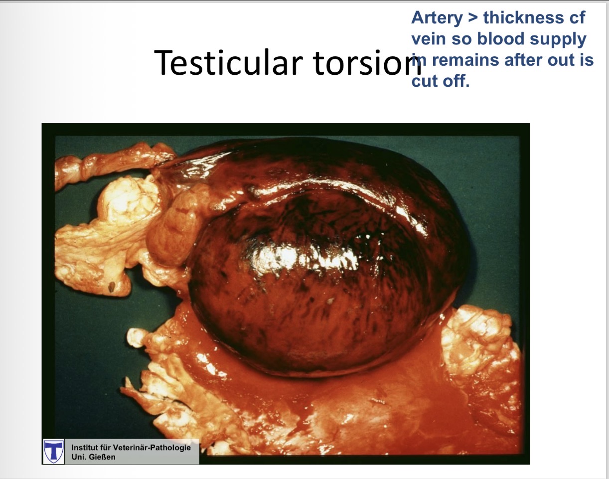 <p>testicular torsion - cause</p>