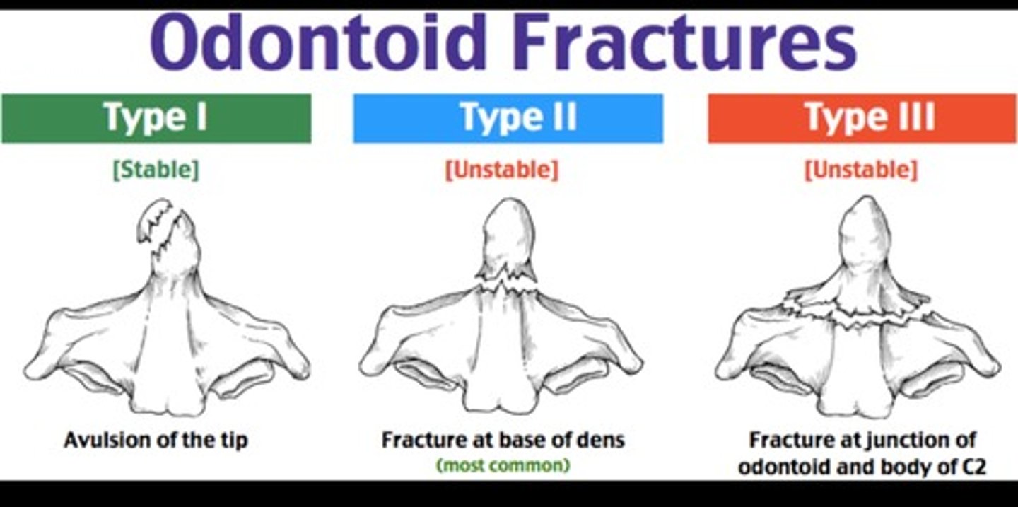 <p>type II (horizontal fracture across base)</p>