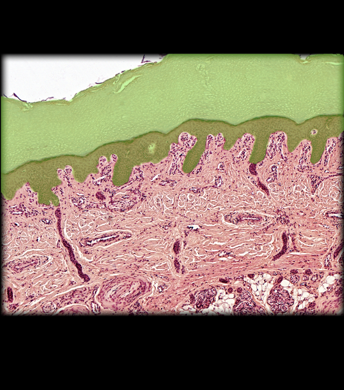 term image