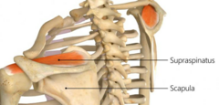 <p>Supraspinous fossa of scapula</p>