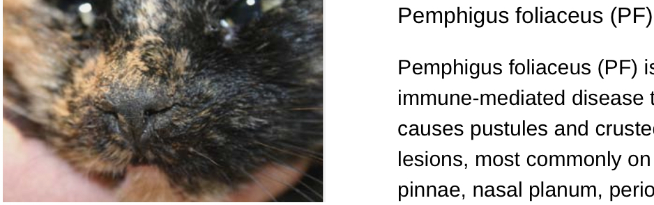 <p>Pemphigus:DX</p>