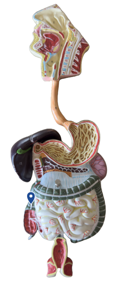 <p>Name this segment of the large intestine.</p>