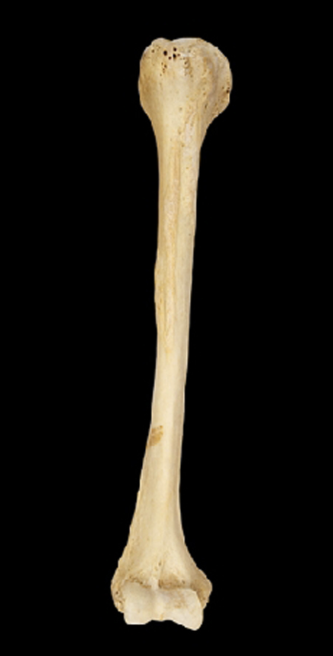<p>anterior view, right side</p>