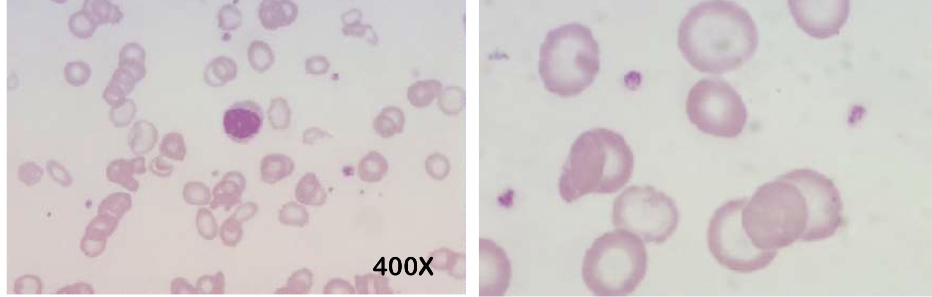 <p>Name this RBC</p>
