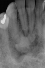 <p>describe the appearance of the lesion:</p>