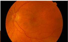 <p>Name the condition</p>