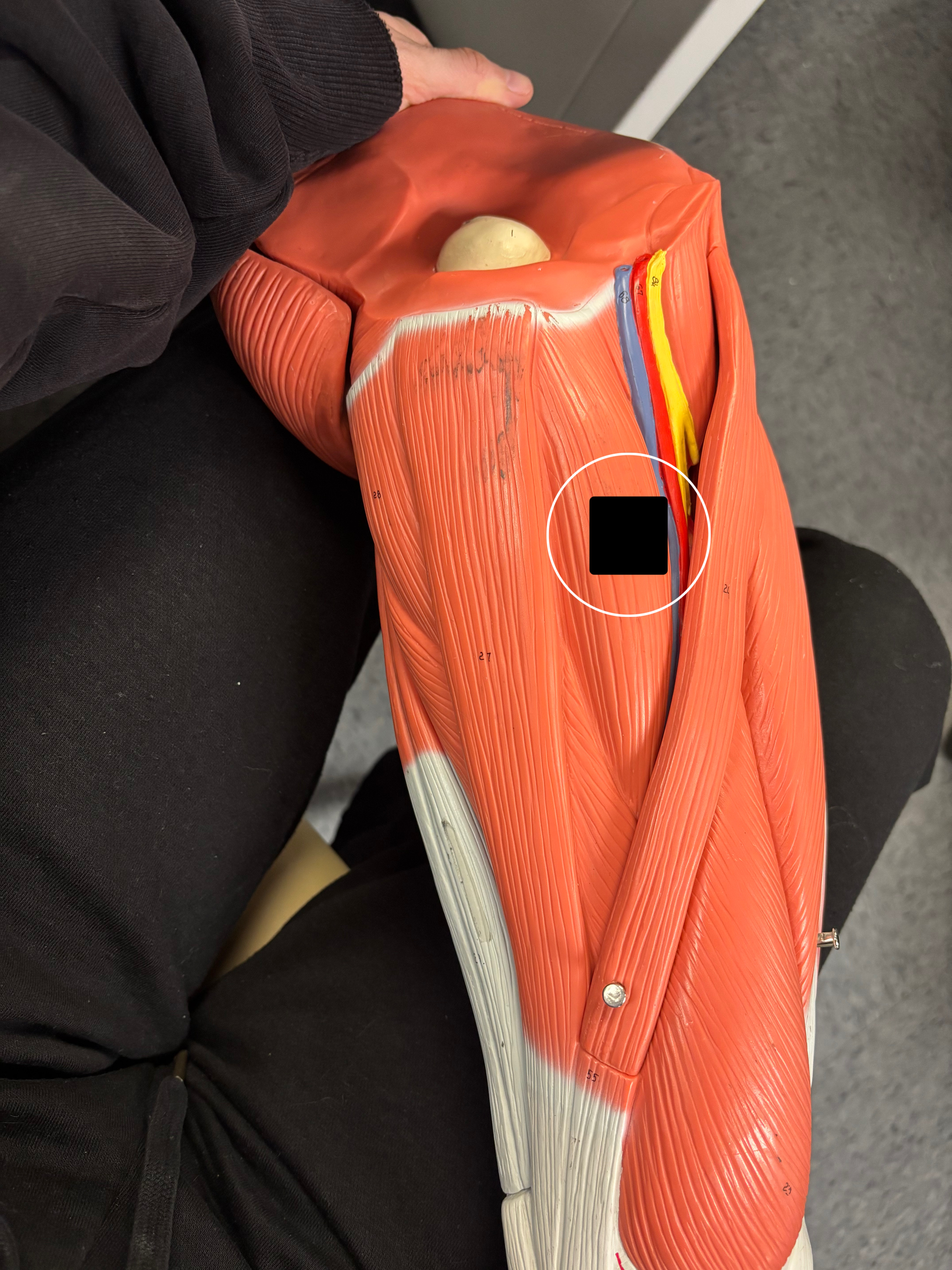 <p>What muscle is this and what is its action?</p>