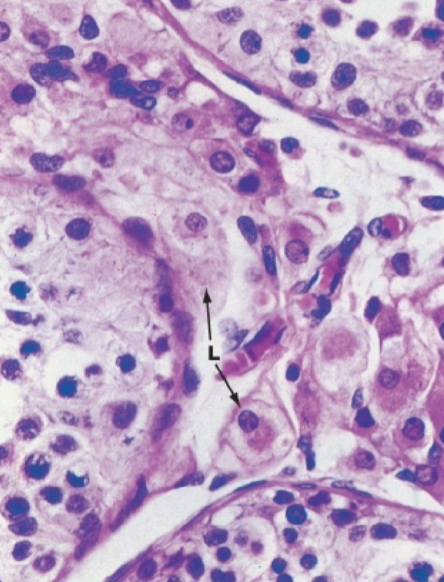 <p>What is the arrow pointing at?</p>