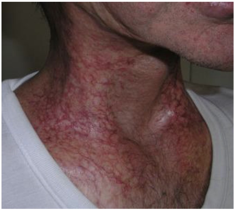 <p>CHẨN ĐOÁN?</p>