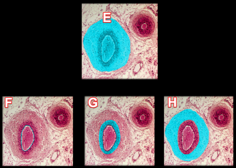 <p><strong>Label E </strong>is a histology picture of the ______ (Pick either artery or vein)</p>