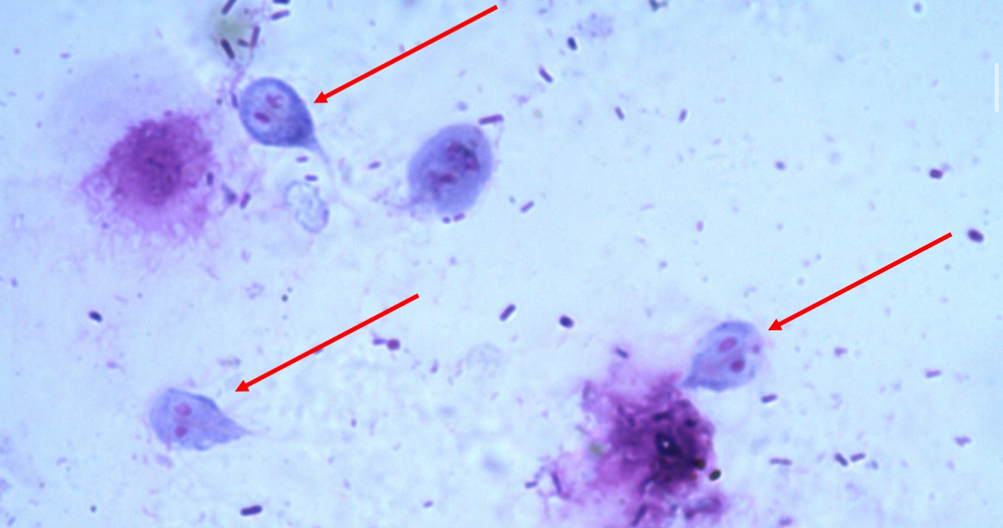 <p>“smiley face” - 2 nuclei</p>