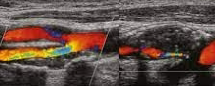 <p>Presence and direction of blood flow </p>