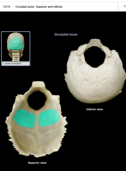 <p>Cerebellar fossa</p>