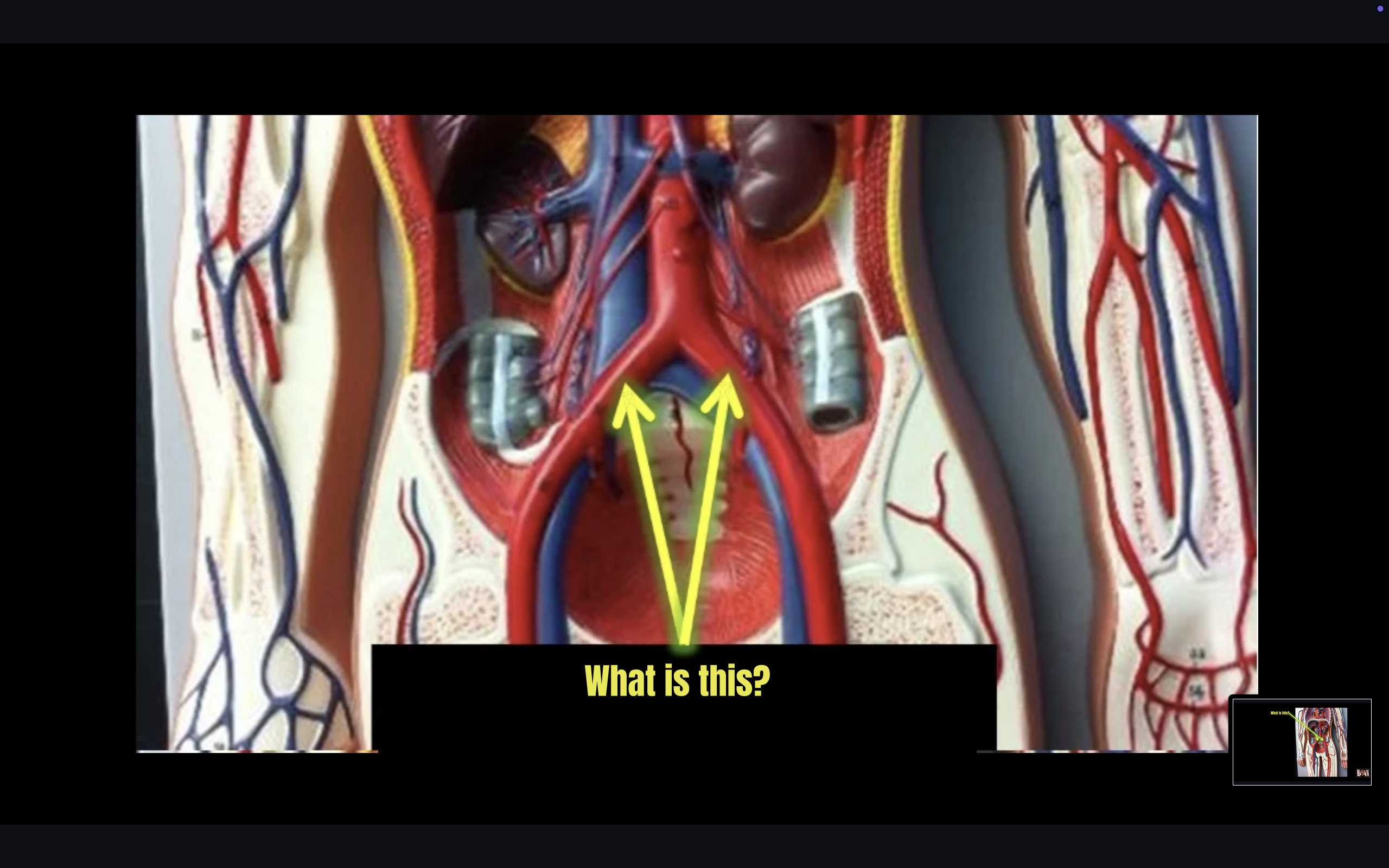 term image