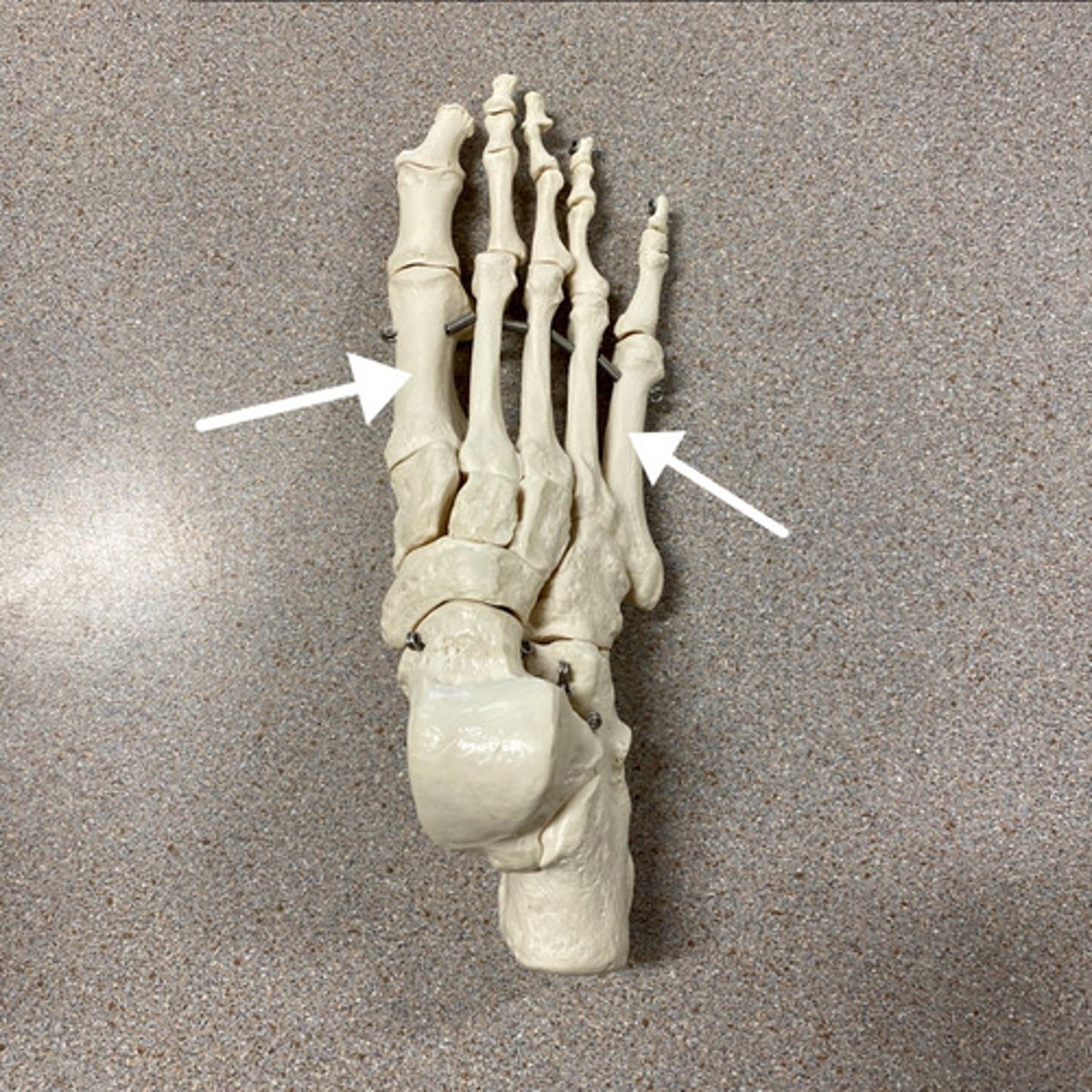 <p>What are these bones?</p>