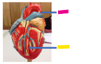 <p>What is the pink arrow?</p>
