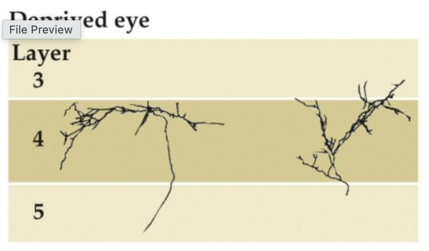 <p>Deprived eye</p>