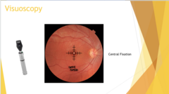 <p>Visuoscopy Central Fixation (Pic)</p>