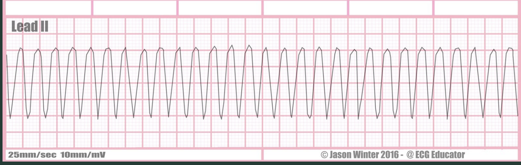 <p>ID this rhythm?</p>