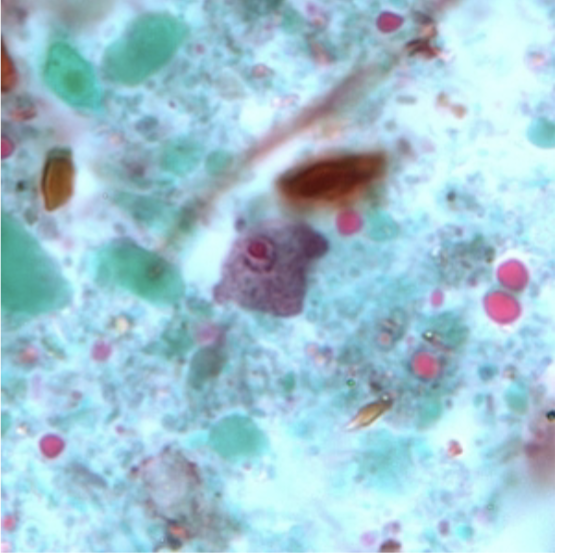 <p>-8-20 microns</p><p>-Vacuolated and granular</p>