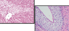 <p>What is being shown? Parenchymal organ.</p>