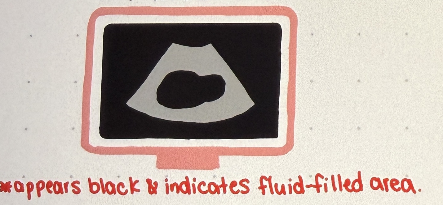 <p>Describing a fluid-filled structure that is without internal echoes and transmits sound easily.</p>