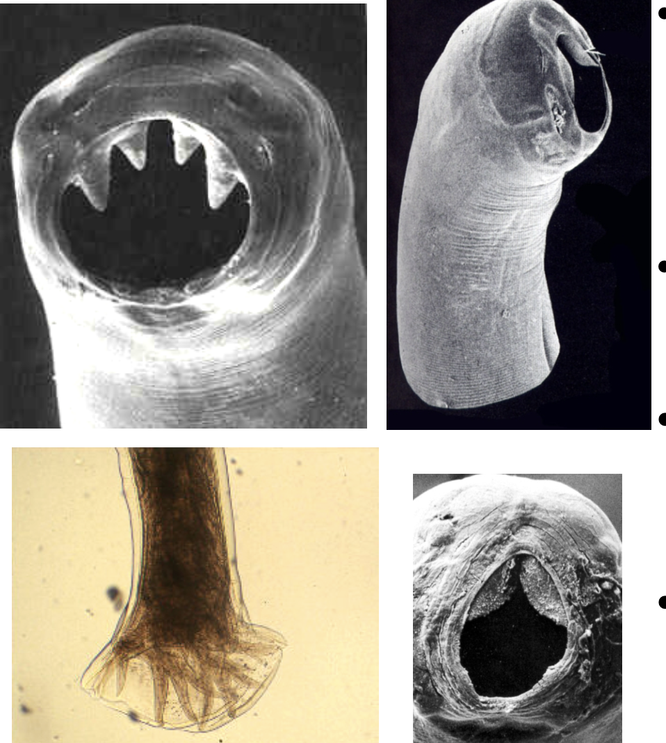 <p>necator americanus</p>