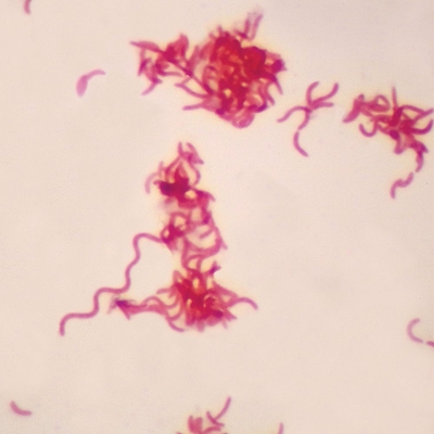<p>What is the morphology of this bacterium?</p>