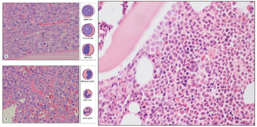<p>- made in bone marrow adjacent to fine shards of bone called trabecular bone</p><p>- most monocytes dont have granules</p>
