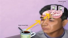<p>analysis that begins with the sensory receptors and works up to the brain's integration of sensory information</p>