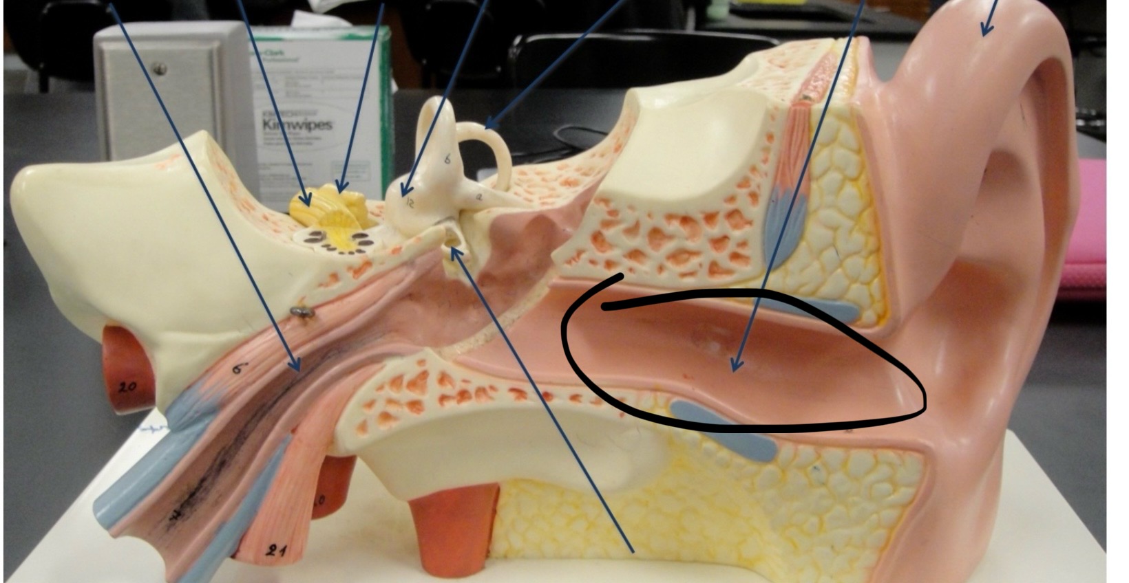 <p>Identify the circled area?</p>