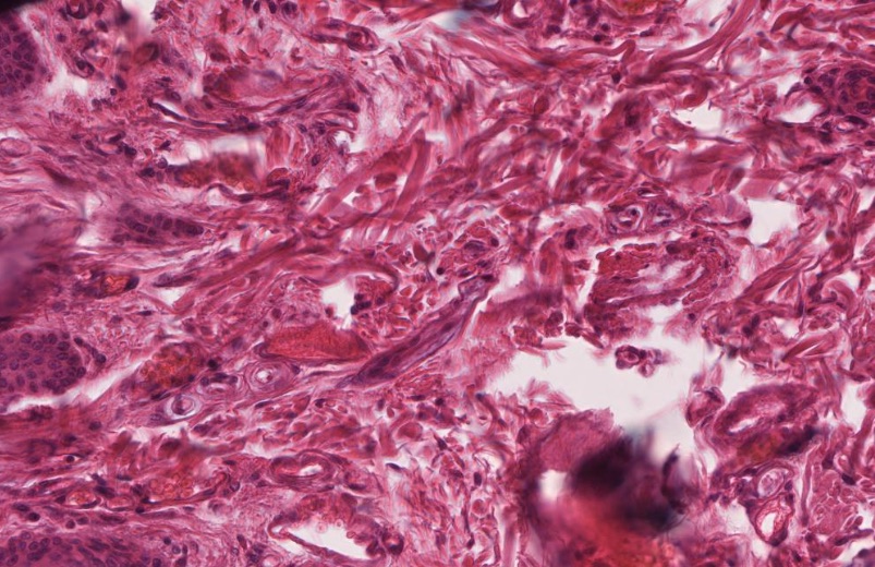 <p>LOTs of collagen fibers. Tension in many directions. Covers kidneys, bone, muscle, and cartilage </p>