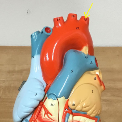 <p>name this artery </p>