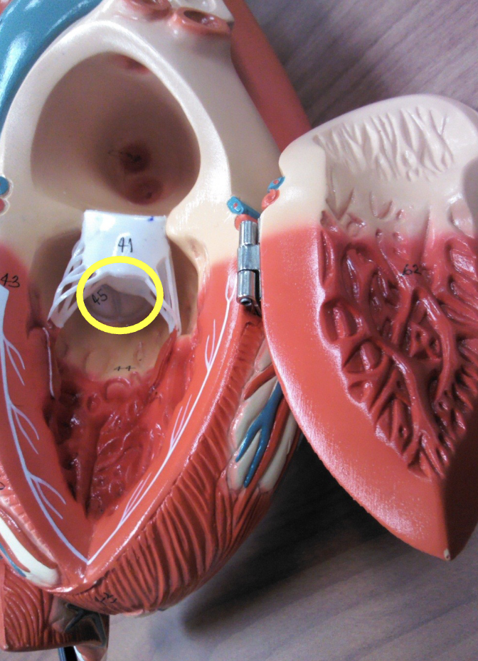 <p>what part of the heart muscle is shown?</p>