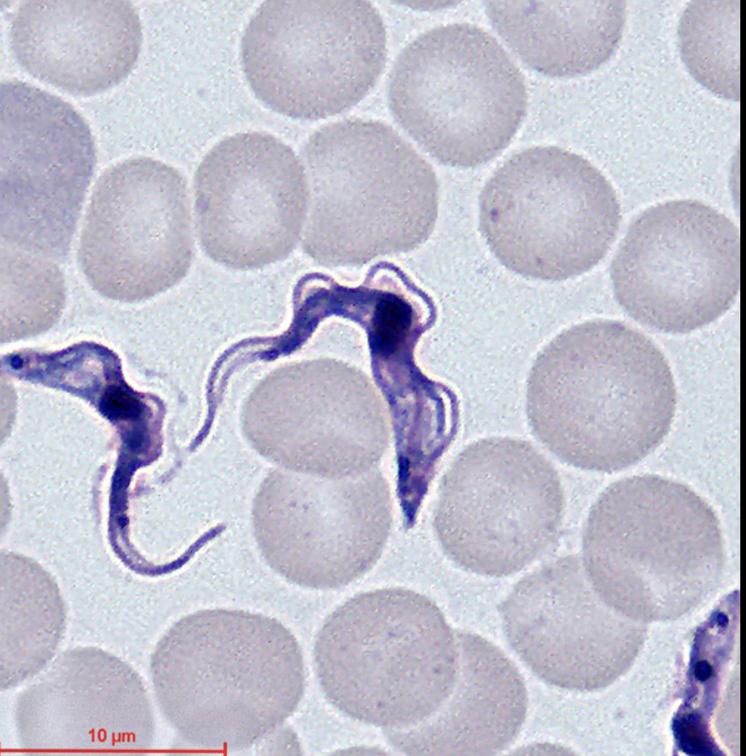 <p>Name: Trypanosoma brucei</p><p class="p1">Stage: trypomastigote</p><p class="p1">*Kinetoplast posterior to nucleus.</p>